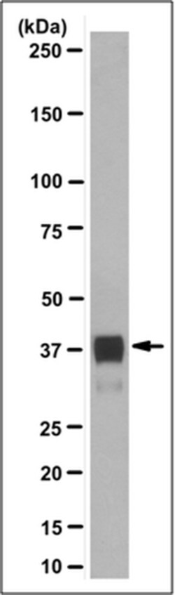 MilliporeSigma ANKRD1/CARP, Mouse, Unlabeled, Clone: 12G8.2, 100&mu;g;